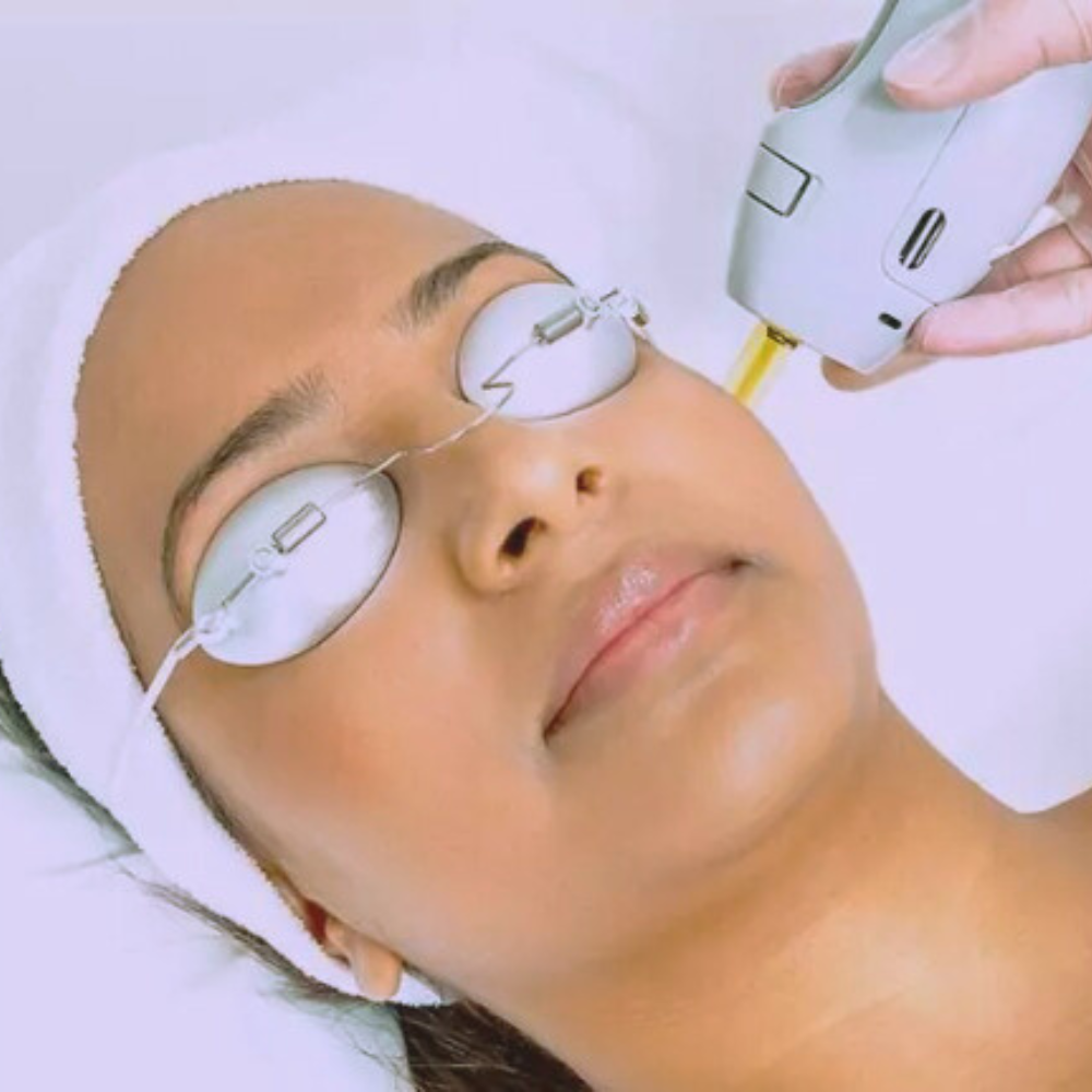 Laser Facial Laser Facial
